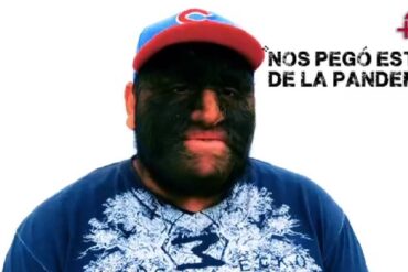 hombre lobo Alex