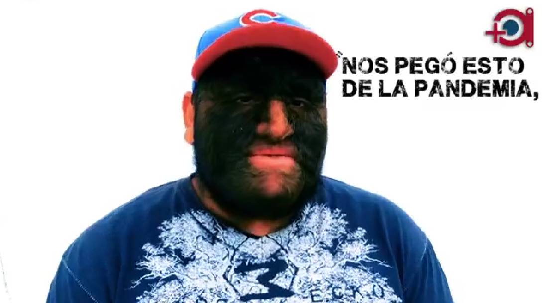 hombre lobo