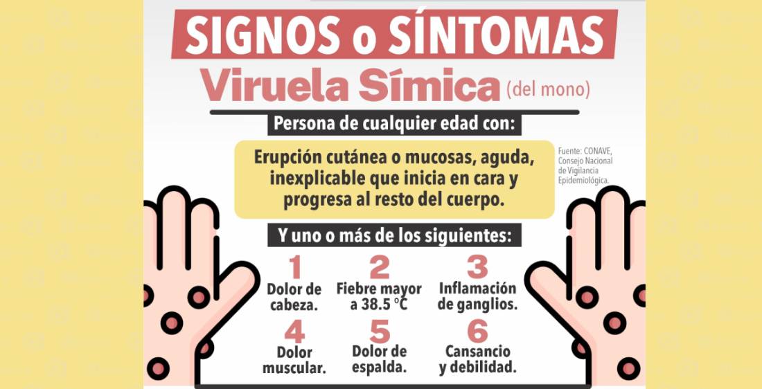 viruela de mono sintomas